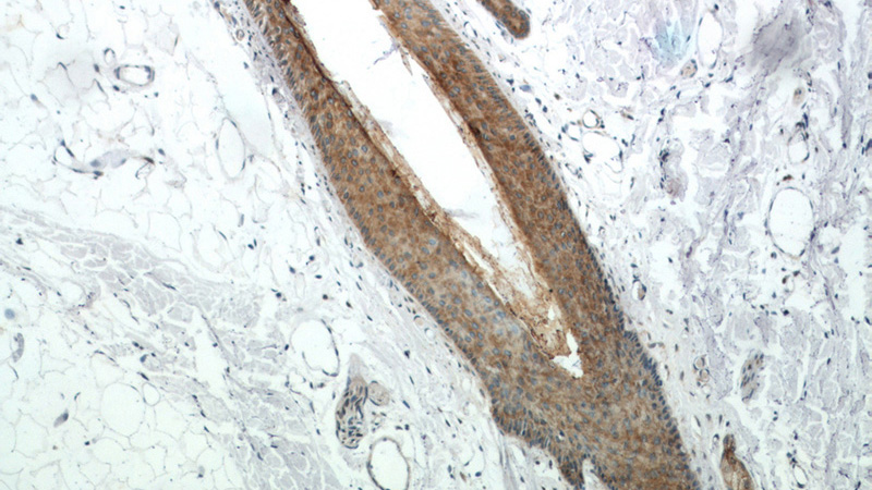 Immunohistochemical of paraffin-embedded human skin using Catalog No:112131(KRT34 antibody) at dilution of 1:50 (under 10x lens)