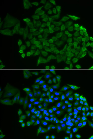 Immunofluorescence - COG2 Polyclonal Antibody 