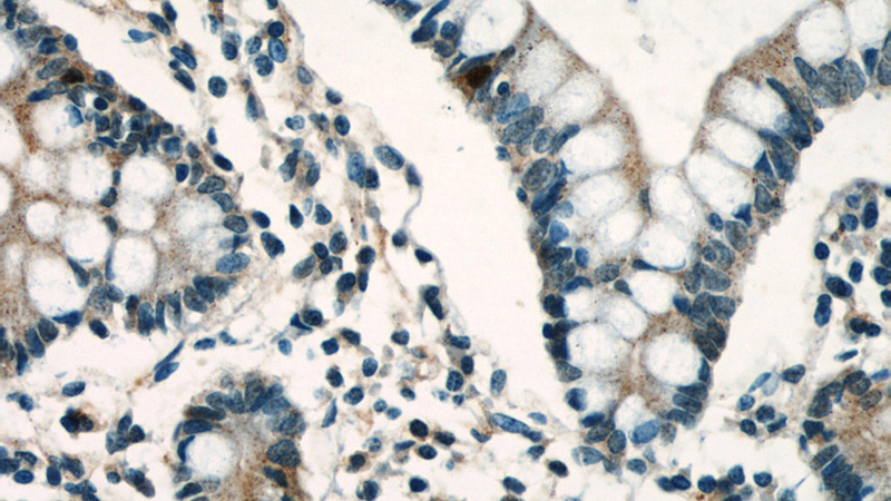 Immunohistochemical of paraffin-embedded human small intestine using Catalog No:112232(Lin28A-specific antibody) at dilution of 1:50 (under 40x lens)