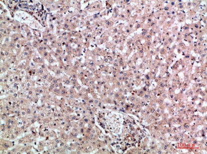 Fig2:; Immunohistochemical analysis of paraffin-embedded human-liver, antibody was diluted at 1:200