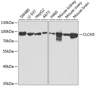 Western blot - CLCN5 Polyclonal Antibody 