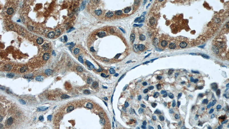 Immunohistochemistry of paraffin-embedded human kidney tissue slide using Catalog No:113573(PANX1 Antibody) at dilution of 1:50 (under 40x lens)
