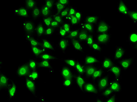 Immunofluorescence - HNRNPM Polyclonal Antibody 