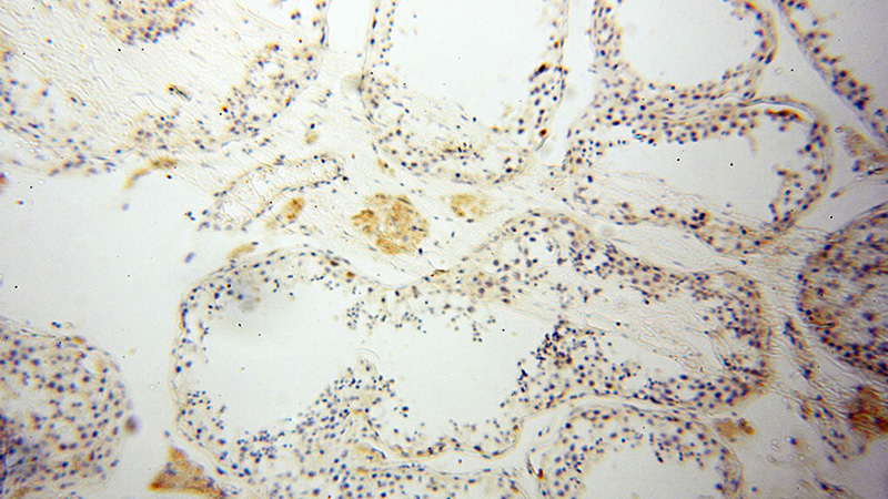 Immunohistochemical of paraffin-embedded human testis using Catalog No:113288(ENO2 antibody) at dilution of 1:100 (under 10x lens)