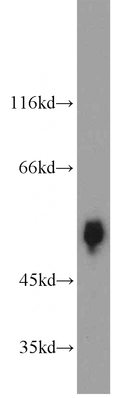 human blood tissue were subjected to SDS PAGE followed by western blot with Catalog No:110624(fetuin-B antibody) at dilution of 1:2000