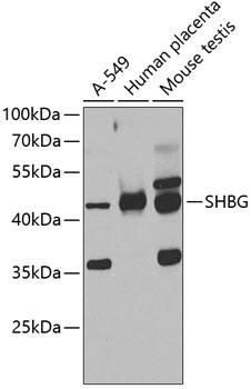 Western blot - SHBG Polyclonal Antibody 