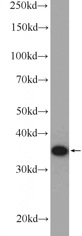 mouse thymus tissue were subjected to SDS PAGE followed by western blot with Catalog No:116551(UFD1L Antibody) at dilution of 1:1000