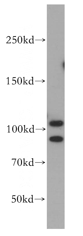 HeLa cells were subjected to SDS PAGE followed by western blot with Catalog No:115452(SND1 antibody) at dilution of 1:300