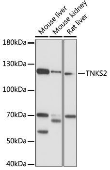 Western blot - TNKS2 Polyclonal Antibody 