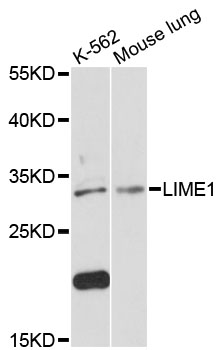 Western blot - LIME1 Polyclonal Antibody 