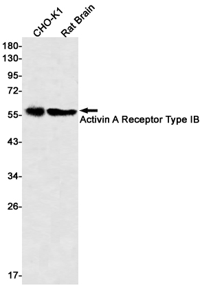 Western blot detection of Activin A Receptor Type IB in CHO-K1,Rat Brain lysates using Activin A Receptor Type IB Rabbit mAb(1:500 diluted).Predicted band size:57kDa.Observed band size:57kDa.