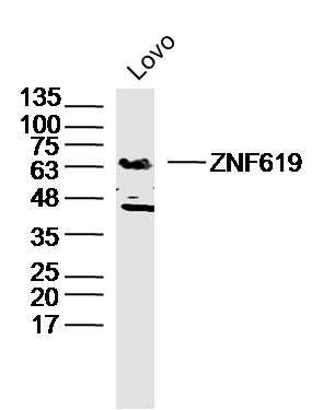 Fig1: Sample: Lovo Cell (Human) Lysate at 40 ug; Primary: Anti- ZNF619 at 1/300 dilution; Secondary: IRDye800CW Goat Anti-Rabbit IgG at 1/20000 dilution; Predicted band size: 63 kD; Observed band size: 63 kD
