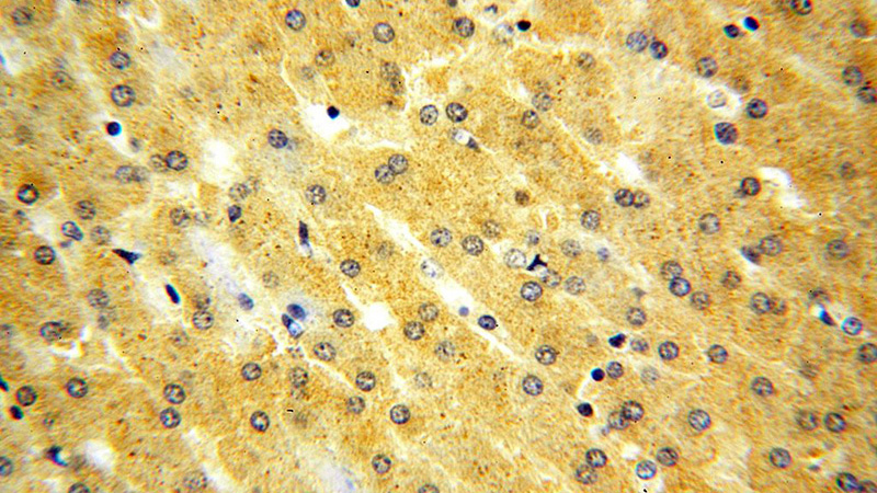 Immunohistochemical of paraffin-embedded human liver using Catalog No:112050(KIF6 antibody) at dilution of 1:50 (under 40x lens)