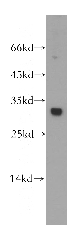 Jurkat cells were subjected to SDS PAGE followed by western blot with Catalog No:113409(NP antibody) at dilution of 1:500