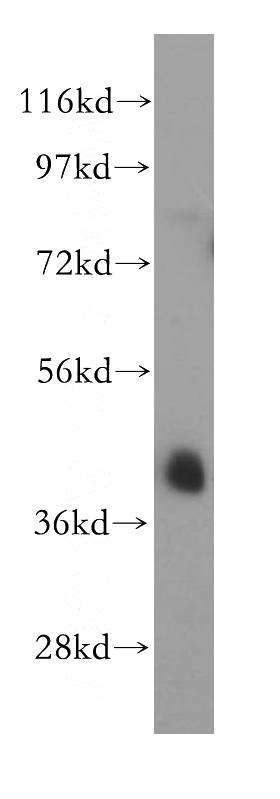 K-562 cells were subjected to SDS PAGE followed by western blot with Catalog No:114323(PTPN7 antibody) at dilution of 1:2000