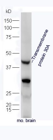 Fig1: Protein: brain(mouse) lysate at 40ug;; Primary: rabbit Anti-Transmembrane protein 30A at 1:300;; Secondary: HRP conjugated Goat-Anti-rabbit IgG(bs-0295G-HRP) at 1: 5000;; Predicted band size: 41 kD; Observed band size: 41 kD