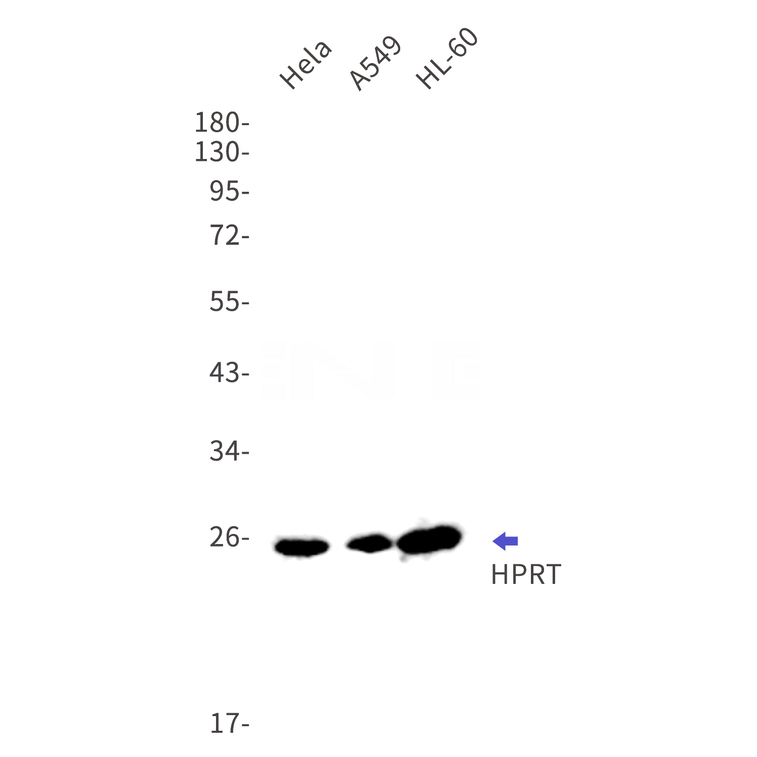 Western blot detection of HPRT in Hela,A549,HL-60 cell lysates using HPRT Rabbit mAb(1:1000 diluted).Predicted band size:25kDa.Observed band size:25kDa.