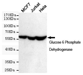 Western blot detection of Glucose 6 Phosphate Dehydrogenase in MCF7,Jurkat and Hela cell lysates using Glucose 6 Phosphate Dehydrogenase mouse mAb (dilution 1:500).Predicted band size:59 Kda.Observed band size:59KDa.