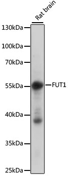 Western blot - FUT1 Polyclonal Antibody 