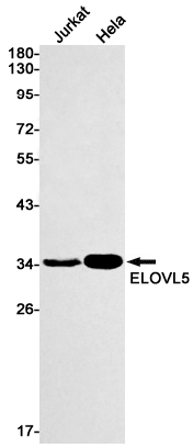Western blot detection of ELOVL5 in Jurkat,Hela cell lysates using ELOVL5 Rabbit mAb(1:1000 diluted).Predicted band size:35kDa.Observed band size:35kDa.
