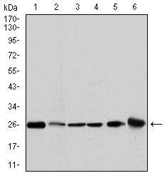 Western blot analysis using GSTM1 mouse mAb against MCF-7 (1), PC-12 (2), Jurkat (3), Hela (4), HL7702 (5) and HepG2 (6) cell lysate.