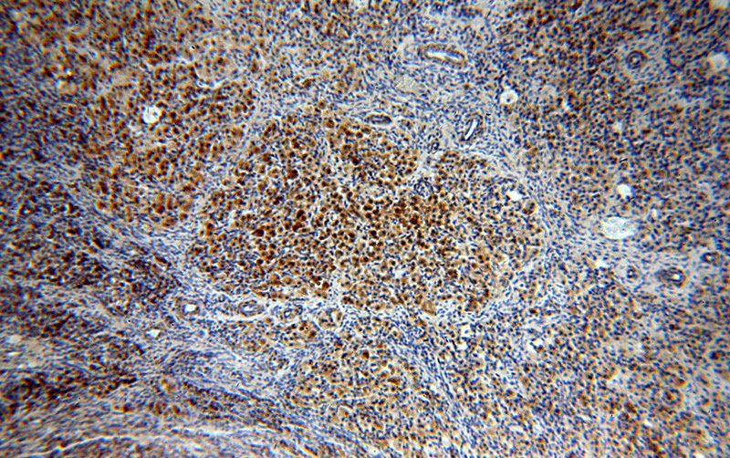 Immunohistochemical of paraffin-embedded human ovary using Catalog No:113499(PAK2 antibody) at dilution of 1:100 (under 10x lens)