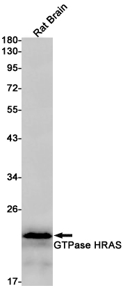 Western blot detection of RAS in Rat Brain lysates using RAS Rabbit pAb(1:1000 diluted).Predicted band size:21kDa.Observed band size:21kDa.