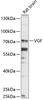 Western blot - VGF Polyclonal Antibody 