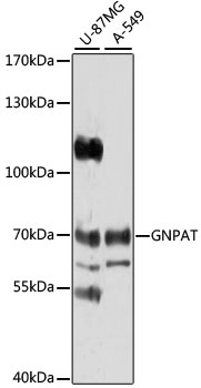 Western blot - GNPAT Polyclonal Antibody 