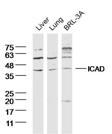 Fig1: Sample:; liver (mouse) Lysate at 40 ug; lung(mouse) Lysate at 40 ug; BRL-3A (rat)cell Lysate at 40 ug; Primary: Anti- ICAD at 1/300 dilution; Secondary: IRDye800CW Goat Anti-Rabbit IgG at 1/20000 dilution; Predicted band size: 36kD; Observed band size: 36 kD