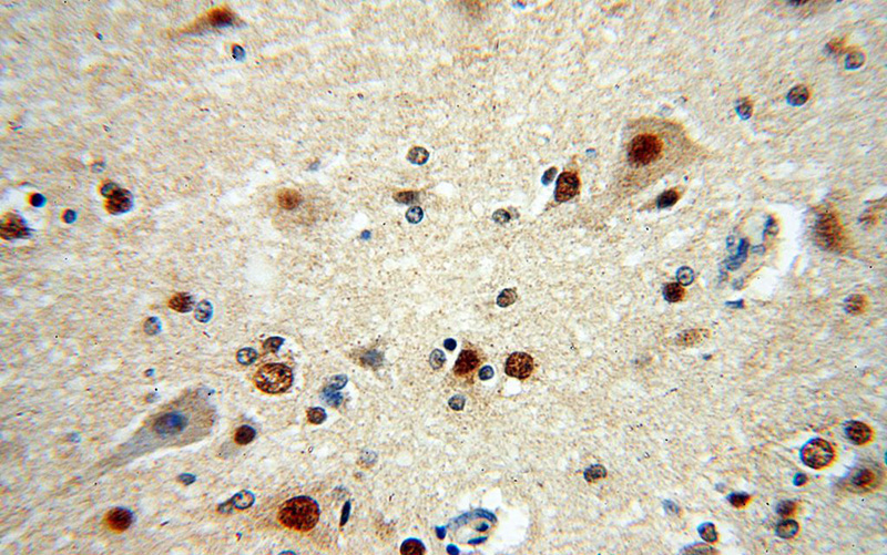 Immunohistochemical of paraffin-embedded human brain using Catalog No:114538(RANBP3L antibody) at dilution of 1:100 (under 40x lens)