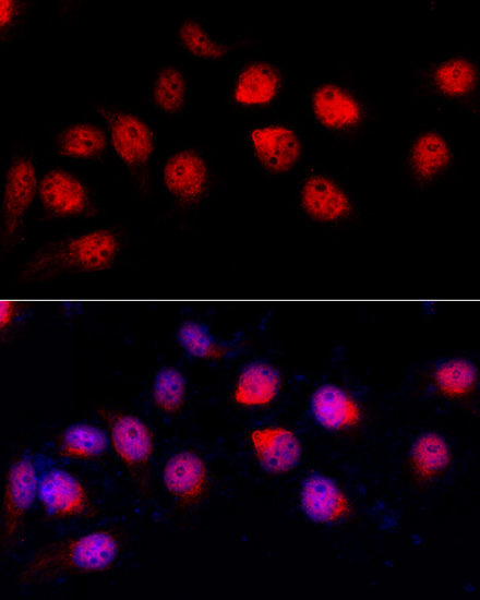 Immunofluorescence - ADAR Polyclonal Antibody 