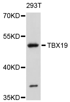 Western blot - TBX19 Polyclonal Antibody 