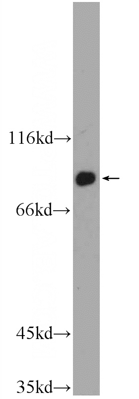 mouse brain tissue were subjected to SDS PAGE followed by western blot with Catalog No:113456(KIAA1486 Antibody) at dilution of 1:1000