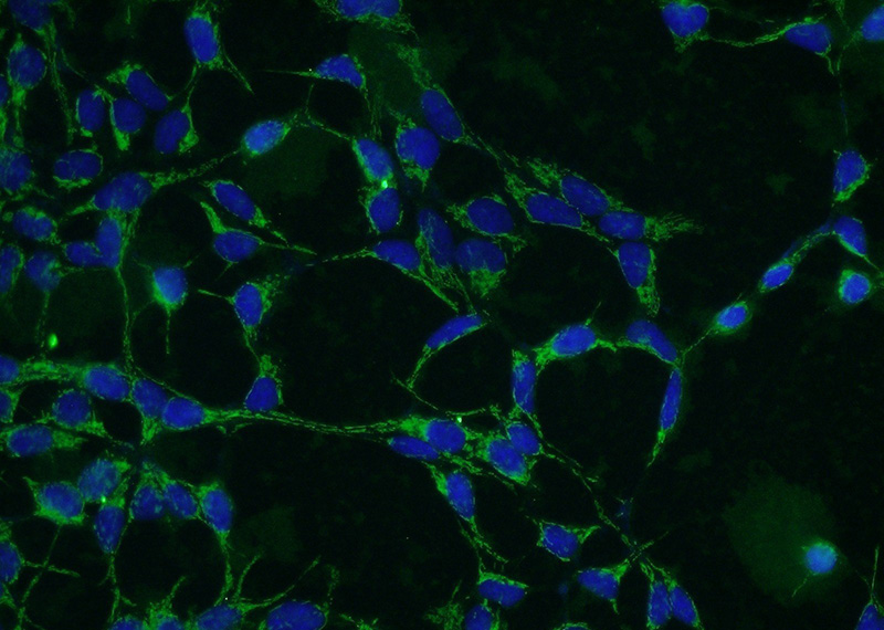 Immunofluorescent analysis of HEK-293 cells using Catalog No:107608(STIM1 Antibody) at dilution of 1:50 and Alexa Fluor 488-congugated AffiniPure Goat Anti-Mouse IgG(H+L)