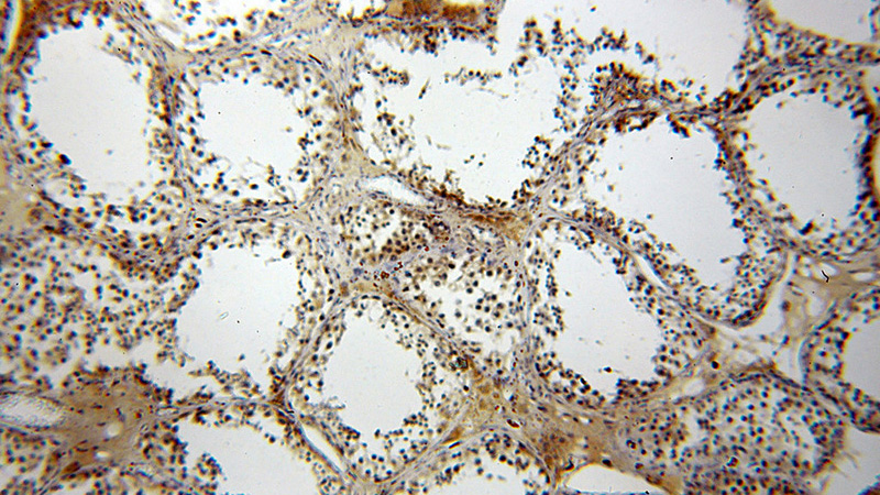 Immunohistochemical of paraffin-embedded human testis using Catalog No:113134(NTF4 antibody) at dilution of 1:100 (under 10x lens)