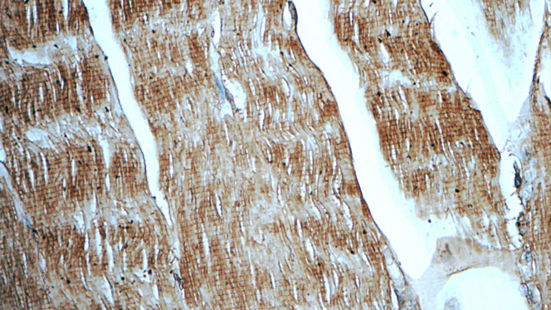 Immunohistochemistry of paraffin-embedded human skeletal muscle tissue slide using Catalog No:113000(MYPN-Specific Antibody) at dilution of 1:50 (under 40x lens)