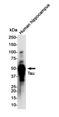 Western blot detection of Tau in Human Hippocampus lysates using Tau Rabbit pAb(1:1000 diluted).Predicted band size:79KDa.Observed band size:50-80KDa.