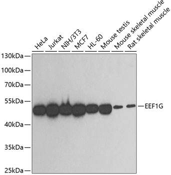 Western blot - EEF1G Polyclonal Antibody 