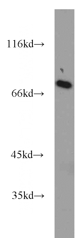 HeLa cells were subjected to SDS PAGE followed by western blot with Catalog No:114974(SASS6 antibody) at dilution of 1:1000