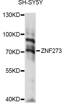 Western blot - ZNF273 Polyclonal Antibody 
