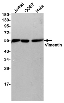 Western blot detection of Vimentin in Jurkat,COS7,Hela cell lysates using Vimentin (10E2) Mouse mAb(1:2000 diluted).Predicted band size:50-57KDa.Observed band size:55KDa.
