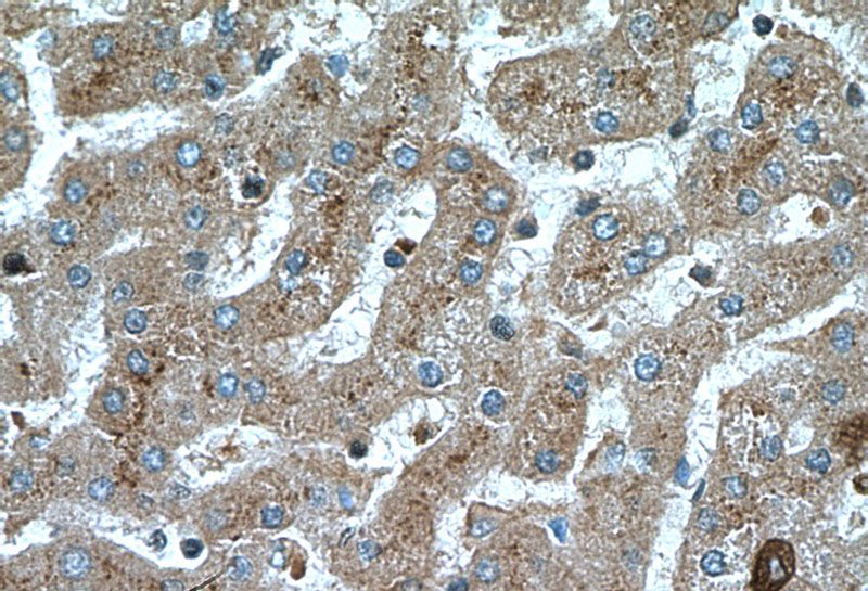 Immunohistochemistry of paraffin-embedded human liver tissue slide using Catalog No:107852(AIFM2 Antibody) at dilution of 1:200 (under 40x lens).