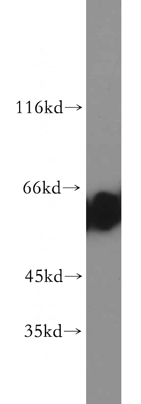 HEK-293 cells were subjected to SDS PAGE followed by western blot with Catalog No:108944(CBX2 antibody) at dilution of 1:500