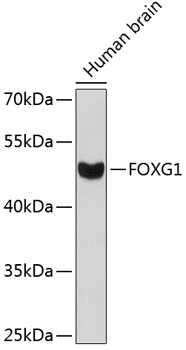 Western blot - FOXG1 Polyclonal Antibody 