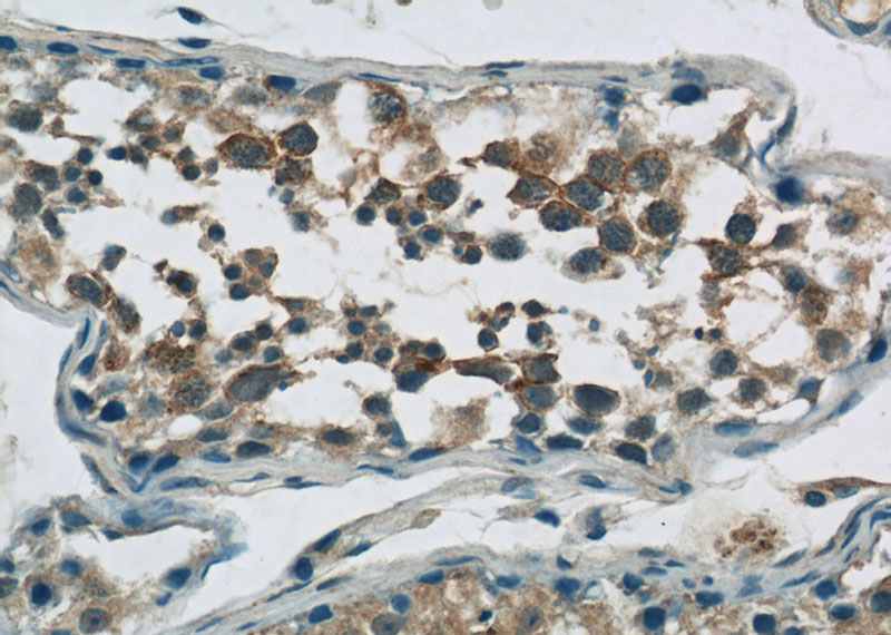 Immunohistochemistry of paraffin-embedded human testis tissue slide using Catalog No:116221(TPTE Antibody) at dilution of 1:50 (under 40x lens)