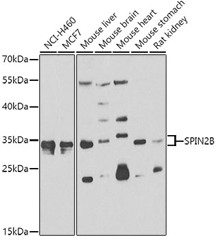 Western blot - SPIN2B Polyclonal Antibody 