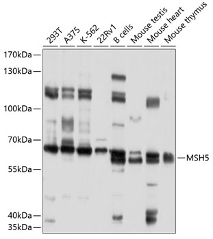 Western blot - MSH5 Polyclonal Antibody 