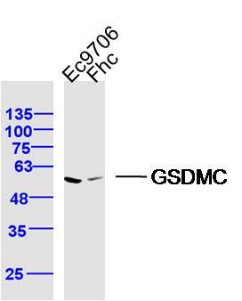 Fig1: Sample:; EC-9706 Cell (Human) Lysate at 40 ug; FHC Cell (Human) Lysate at 40 ug; Primary: Anti- GSDMC at 1/300 dilution; Secondary: IRDye800CW Goat Anti-Rabbit IgG at 1/20000 dilution; Predicted band size: 58 kD; Observed band size: 58 kD