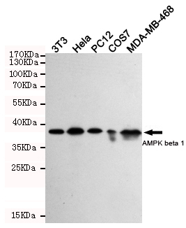 Western blot detection of AMPK beta 1 in 3T3,Hela,PC-12,COS7 and MDA-MB-468 cell lysates using AMPK beta 1 mouse mAb (1:1000 diluted).Predicted band size:38KDa.Observed band size:38KDa.Exposure time:5min.